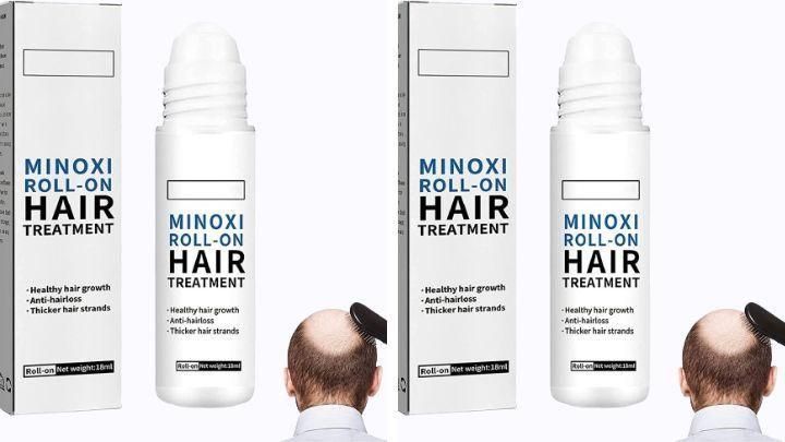 Minoxi Roll-On Hair Treatment Hair Growth Serum For Women & Men (🔥 Buy 1 Get 1 Free 🔥)