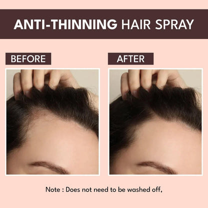 Glam Anti-Thinning Hair Spray - Volumizing Day Spray 100ml (5/5 ⭐⭐⭐⭐⭐ 90,022 Reviews)